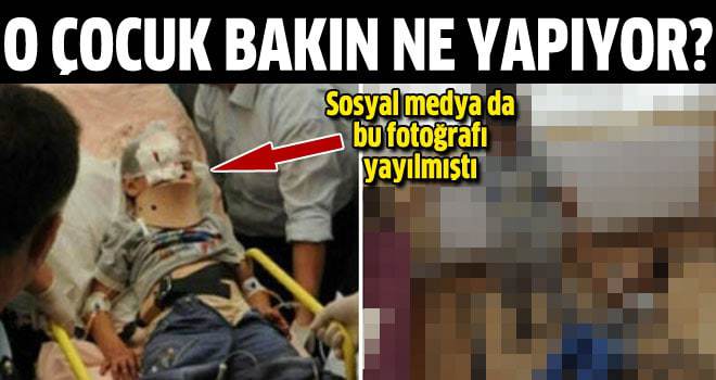 Sosyal medyanın yaralı çocuğu bakın ne yapıyor?