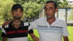 Yüz naklinde bir büyük başarı daha