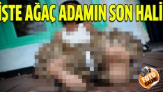 İşte ağaç adamın son hali