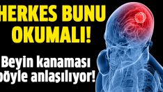Beyin kanaması nasıl anlaşılır?