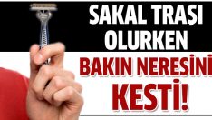 Tıraş olurken bacağını kesti!
