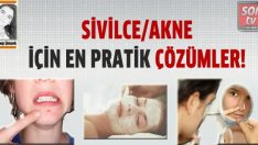 SİVİLCE/AKNE İÇİN EN PRATİK ÇÖZÜMLER!