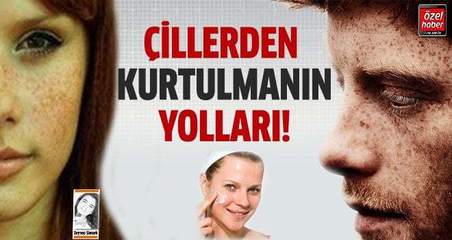 ÇİLLERDEN KURTULMANIN YOLLARI!