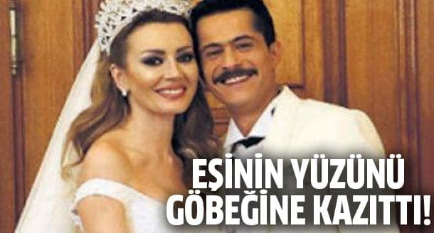 İsmail Hacıoğlu eşinin yüzünü göbeğine kazıdı