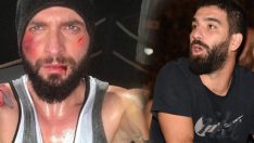 Arda Turan ve Berkay arasında kavga! Arda Berkay’ın burnunu kırdı
