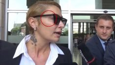 Ahmet Kural’dan şiddet gören Sıla’nın yüzündeki iz dikkat çekti!