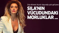 Sıla – Ahmet Kural olayında davanın seyrini değiştirecek gelişme! Sıla’nın vücudundaki morluklar…
