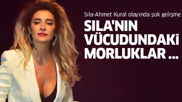 Sıla – Ahmet Kural olayında davanın seyrini değiştirecek gelişme! Sıla’nın vücudundaki morluklar…