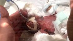 Dünyanın en küçük erkek bebeği, yaşama tutundu!